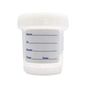 Urine Container – White Cap – 60ml